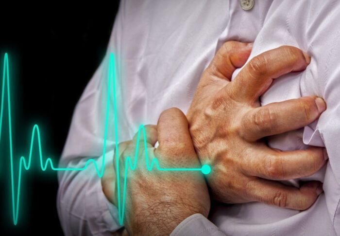 heart attack: Symptoms and treatment